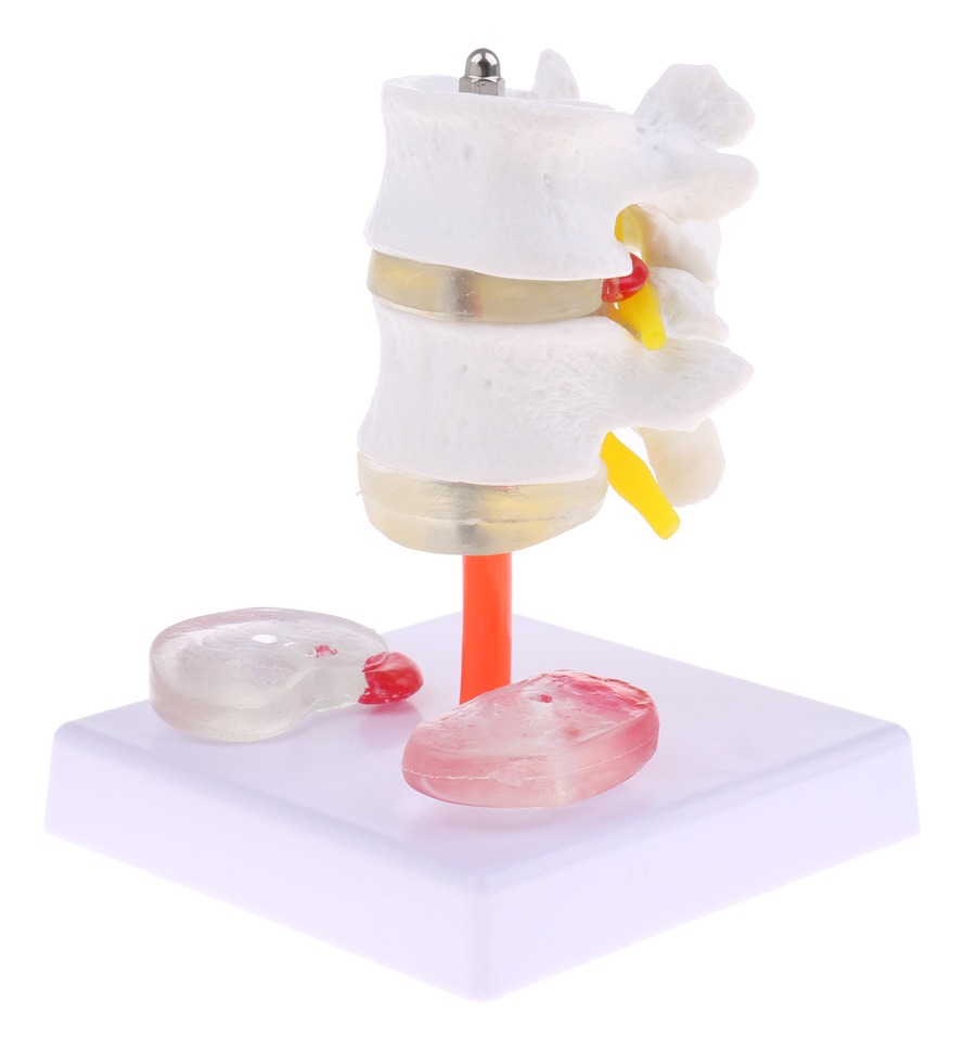 Vértebra Lombar Da Coluna Vertebral Humana 1: 1 Com Modelo - Imagem 3