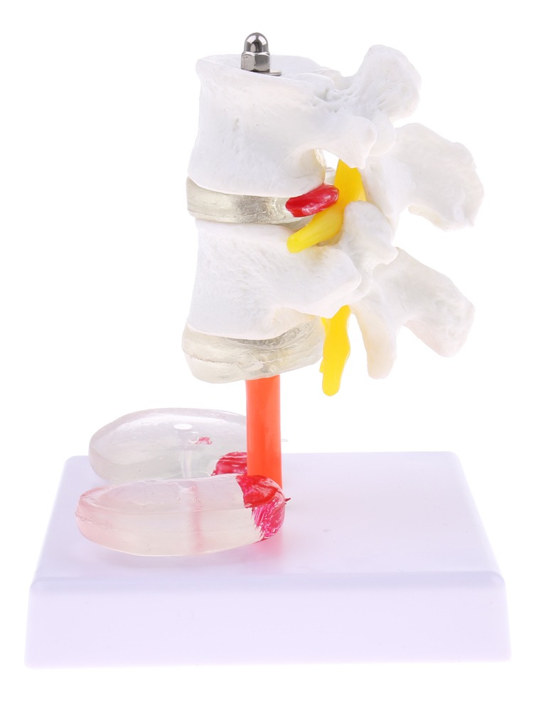 Vértebra Lombar Da Coluna Vertebral Humana 1: 1 Com Modelo - Imagem 8
