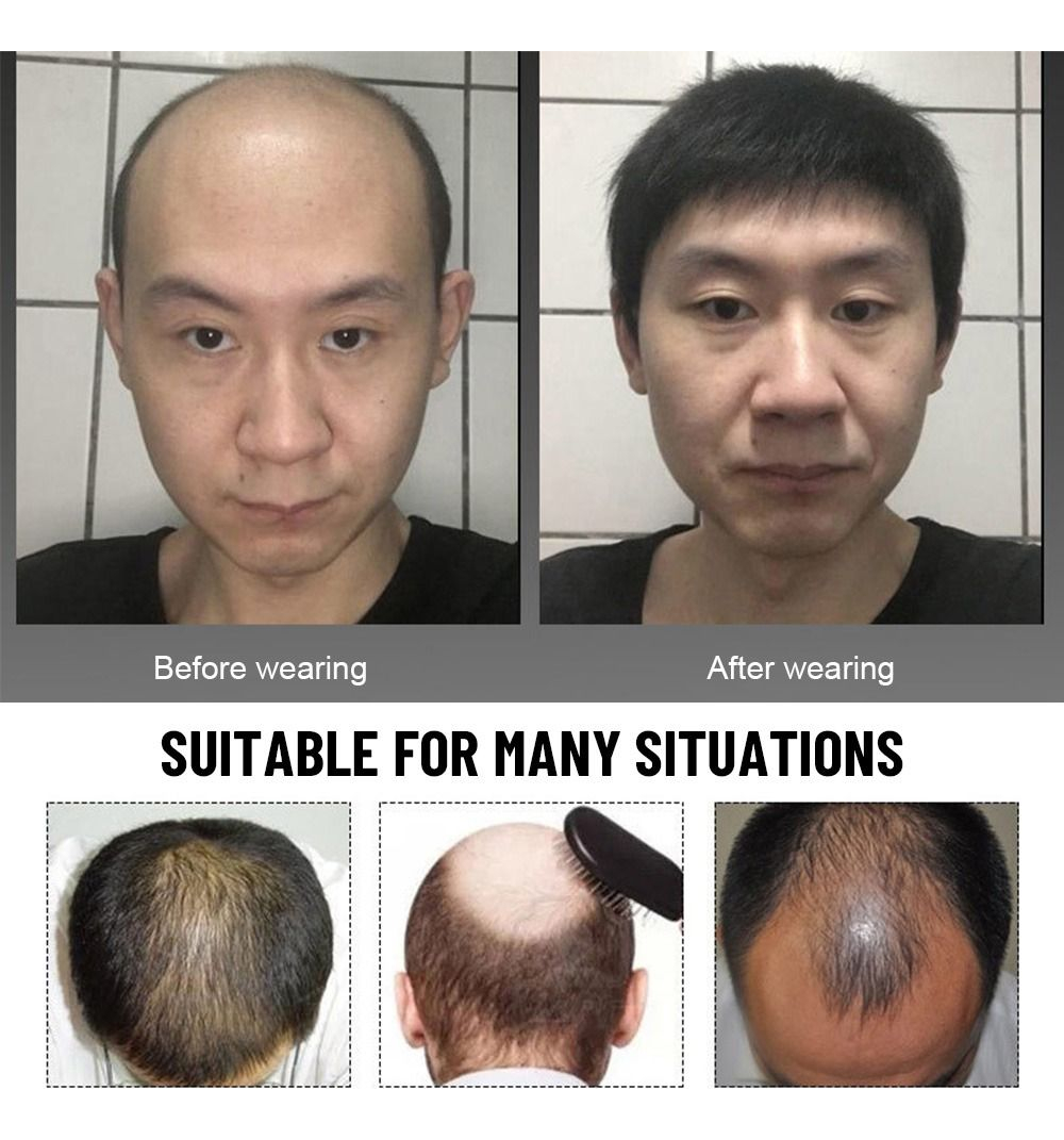 Peruca Masculina Increase Hair Top Hair Patchsintética Fibra - Imagem 3