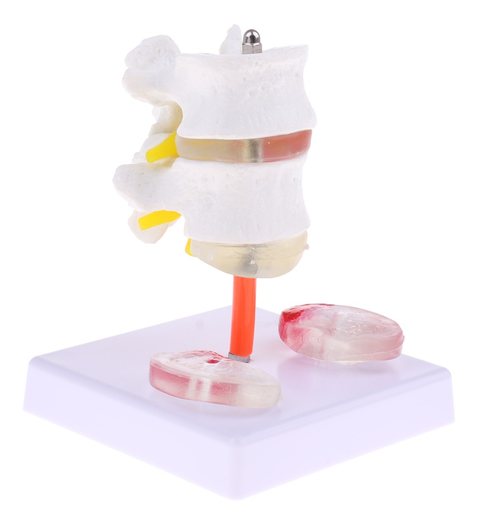 Vértebra Lombar Da Coluna Vertebral Humana 1: 1 Com Modelo - Imagem 7