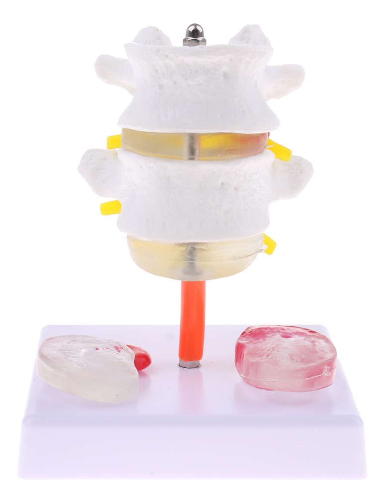 Vértebra Lombar Da Coluna Vertebral Humana 1: 1 Com Modelo - Imagem 2