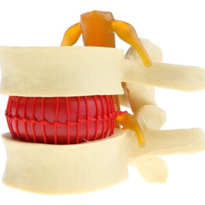 Modelo De Disco Lombar Da Coluna Vertebral Humana