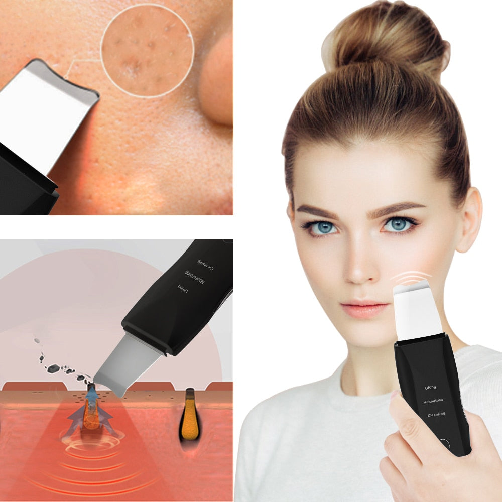 Aparelho - Limpeza Facial Profunda - Imagem 4