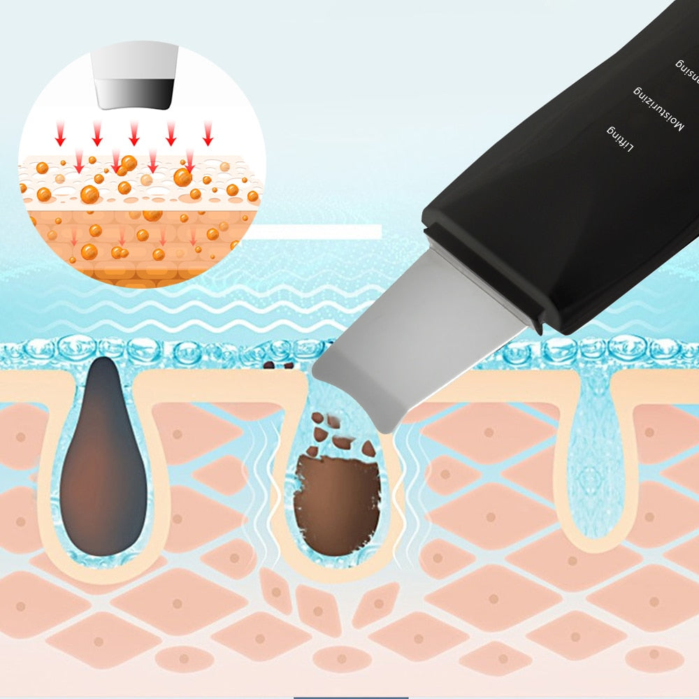 Aparelho - Limpeza Facial Profunda - Imagem 3