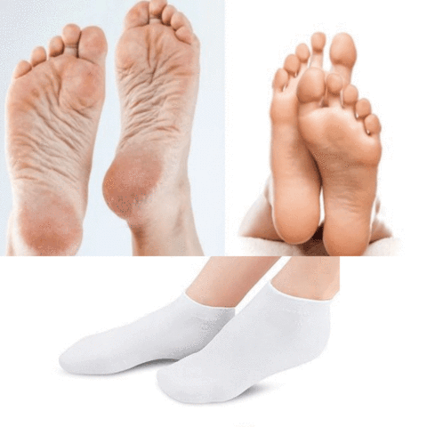 Meia Feminina de Silicone para Hidratar os Pés e Calcanhar - Imagem 4