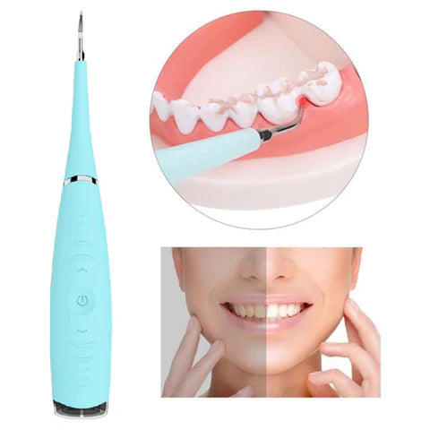 Removedor de Tártaro e Sujeiras - Dental - Imagem 4