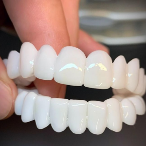 Lente Dental White® 100% ajustável - Kit Superior + Inferior