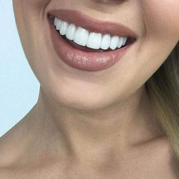Lente Dental White® 100% ajustável - Kit Superior + Inferior - Imagem 2