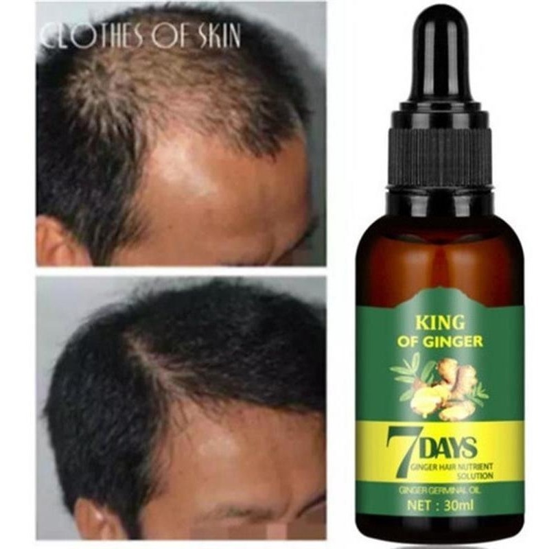 Soro De Crescimento 7 Dias A Pronta Entrega 30ml 3 Unidades - Imagem 3