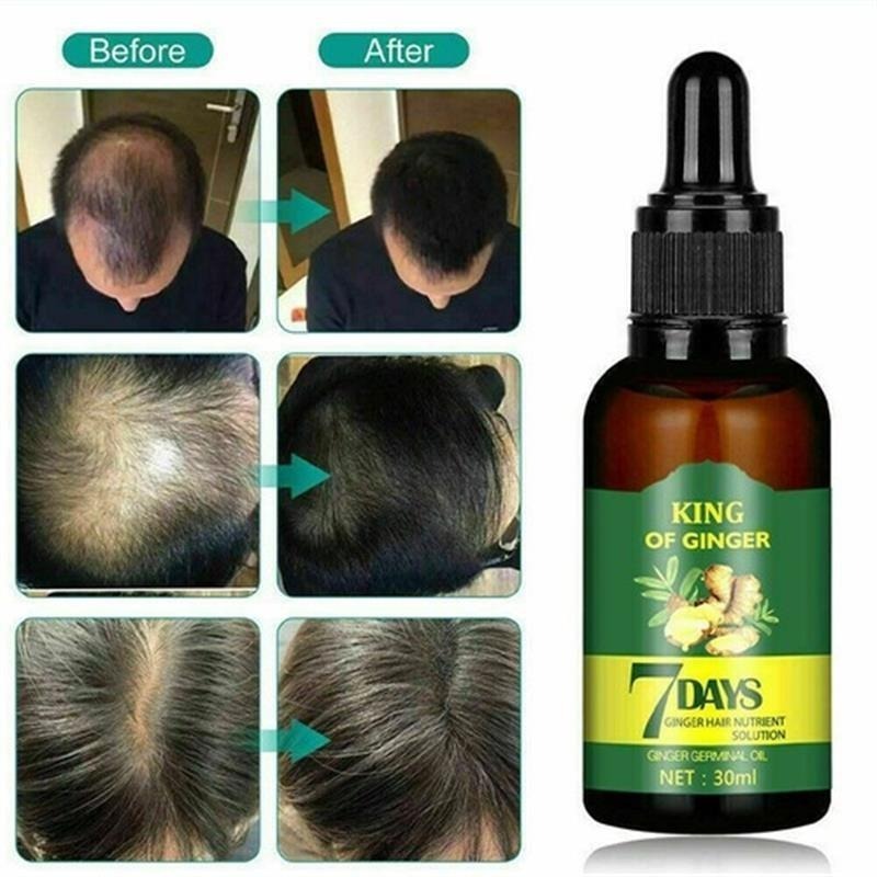 Soro De Crescimento 7 Dias A Pronta Entrega 30ml 3 Unidades - Imagem 2