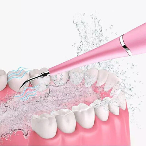 Removedor de Tártaro e Sujeiras - Dental
